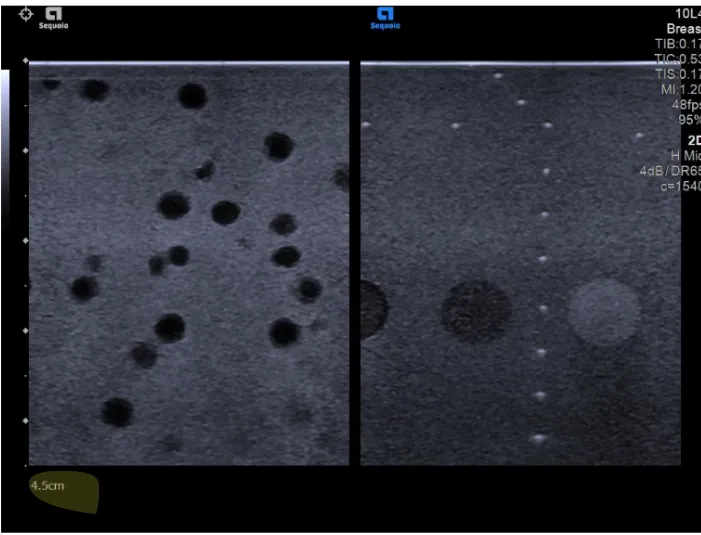 Ultrasound scan illustrating a calibration-drift false positive