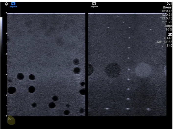 Ultrasound comparison showing spherical target blur after a field-of-view change